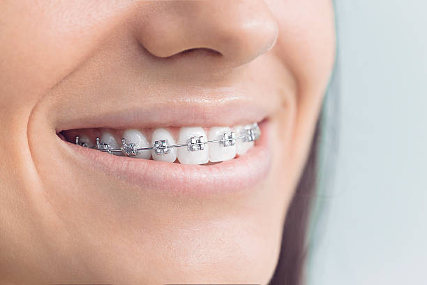 Best Invisalign and Clear Aligners  in Duvall, WA